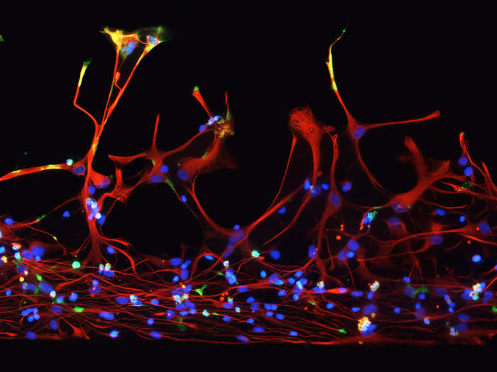 Human neural stem cells