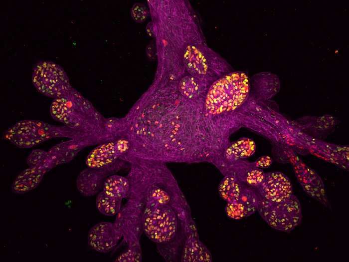 Lab-grown bud of a human mammary gland