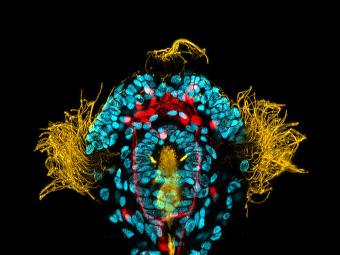 A 3-day-old peanut worm larva (yellow: cilia; blue: DNA; red: serotonin in the nervous system)