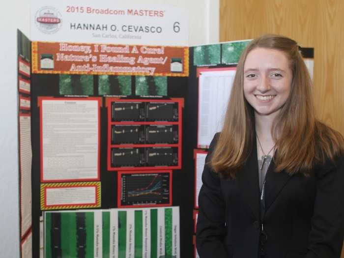 Hannah Cevasco (14) discovered the healing powers of honey.