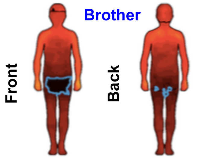 The men surveyed were uncomfortable being touched by brothers anywhere but on their hands, arms, and shoulders.