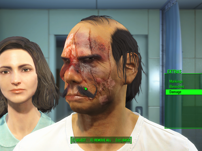 The radiation can only make this gentleman look better.