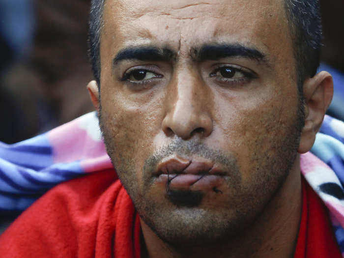 A migrant with his mouth sewn shut in protest sits at the border with Greece near the village of Gevgelija, Macedonia.