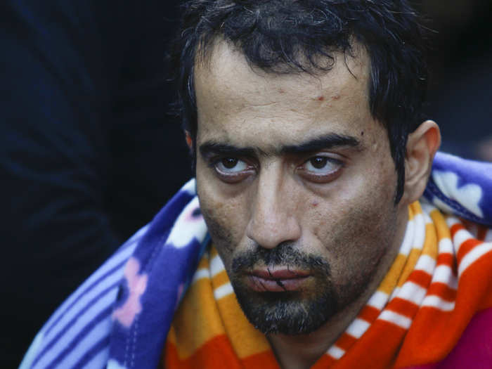 A migrant with his mouth sewn shut in protest sits at the border with Greece near the village of Gevgelija, Macedonia.