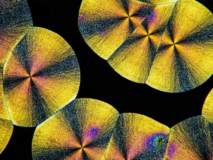 These are the micro crystals of ascorbic acid in polarized light. Asorbic acid is found in the majority of citrus fruits and green vegetables and is vital in maintaining healthy connective tissue.