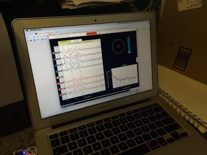 This is the software program he used to measure his brain waves, where each squiggle represents brain activity recorded by one electrode. Some people use this technology, which allows them to watch their brain activity change in real-time, to be more mindful.