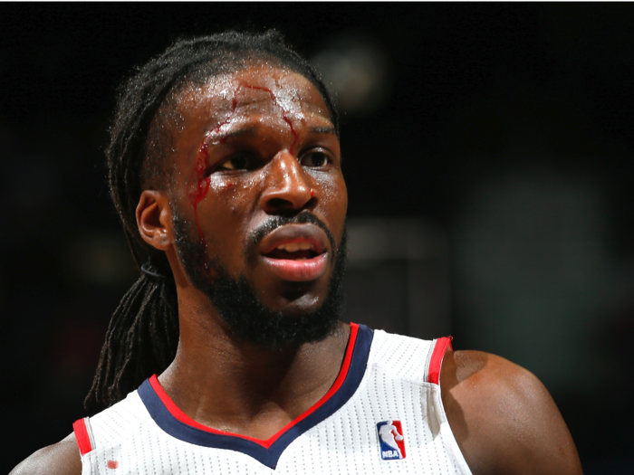 25. DeMarre Carroll, Toronto Raptors — $13.6 million