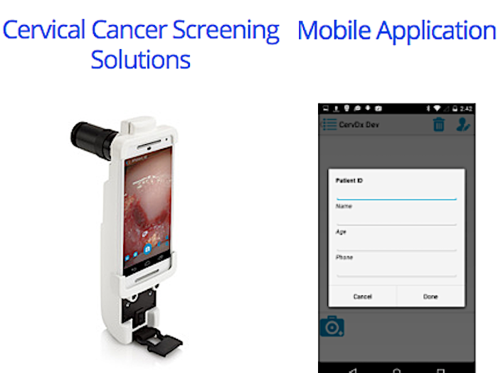 Mobile ODT: Fighting cervical cancer with a cell phone camera