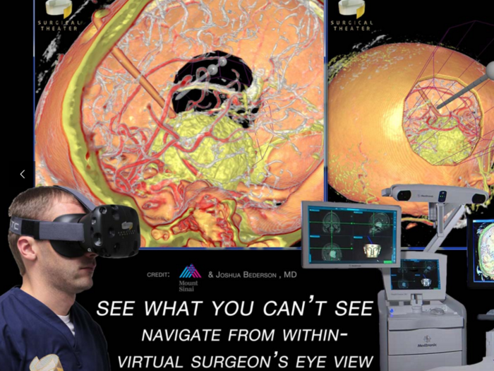 Surgical Theater: virtual reality for neurosurgeons