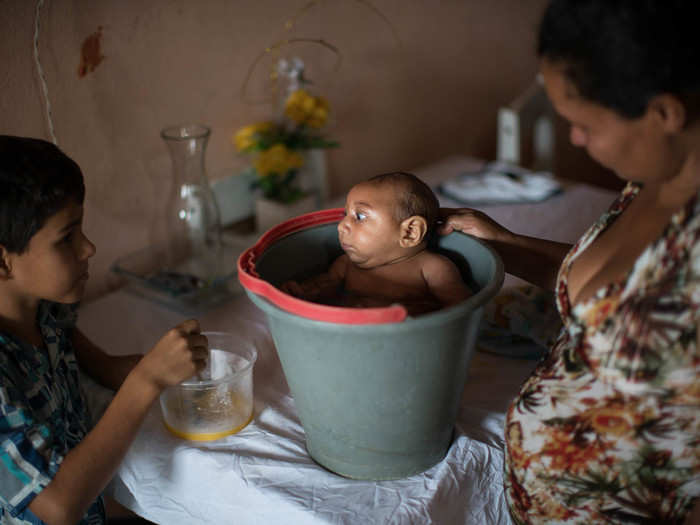 Since the outbreak in Brazil began, 46 babies have died from microcephaly linked with the virus.