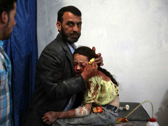 General News Stories, 2nd prize: Abd Doumany, Syria — Douma