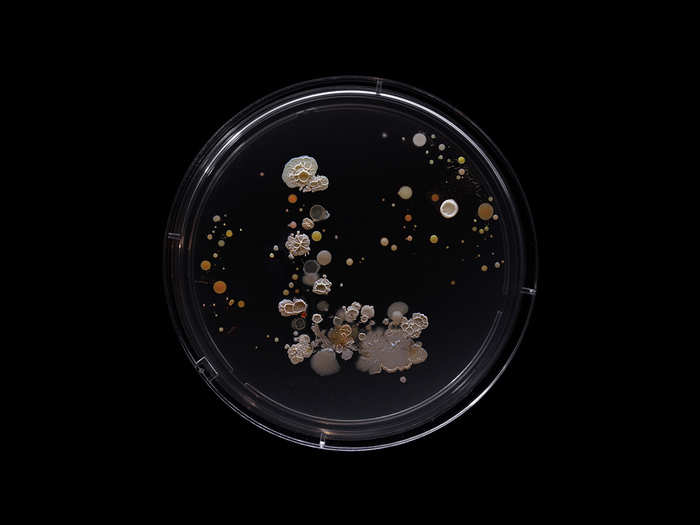 The L train sample contains E. coli, Proteus mirabilis, Micrococcus luteus, Bacillus subtilis, and Serratia marcescens, which Ward describes as "bathroom slime, and the leading cause of hospital-acquired infections."