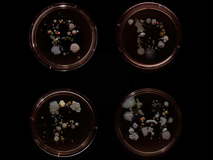 But he does think a bit differently now when he gets onboard with his 2-year old daughter. "I don’t really like to see her touching the railings and then putting her hands in her mouth," he said. Here, the B, D, F, and M lines all had traces of E. coli and some Staphylococcus aureus, which is a common cause of skin infections, sinusitis, and food poisoning.