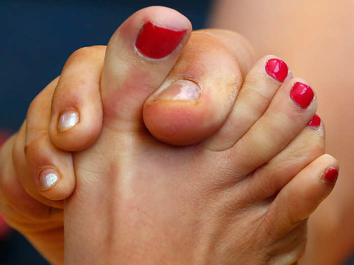 In the very disturbing game of toe wrestling, two people lock feet and battle with their toes, attempting to pin each other