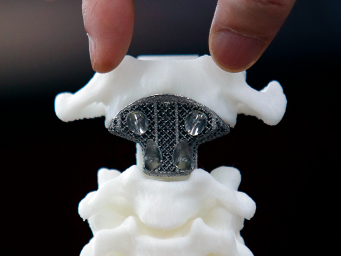 Human organs will be produced by 3D printers.