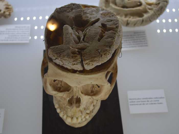 Skull