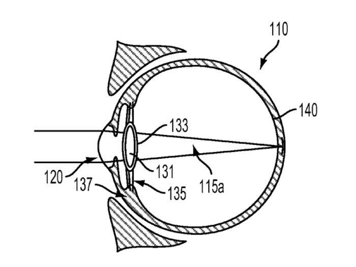 And one for a procedure that could give people bionic eyes.