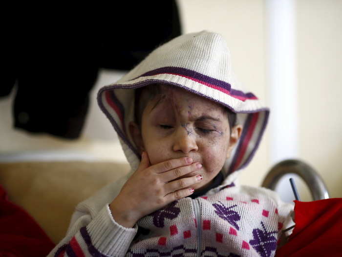 FIve-year-old Sheima was hit by a stray bullet in Syria and lost both her eyes. Here, she is sitting on a hospital bed at a small clinic in Kilis, Turkey.