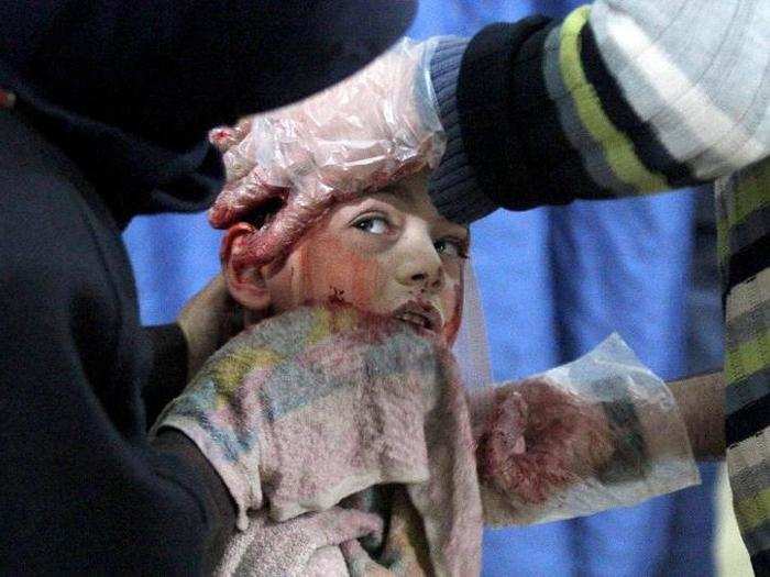 An injured boy receives medical treatment in a hospital after airstrikes hit the Douma neighborhood in Damascus, Syria. Civilians are finding it increasingly difficult to receive medical treatment, as healthcare facilities and workers have been repeatedly attacked.