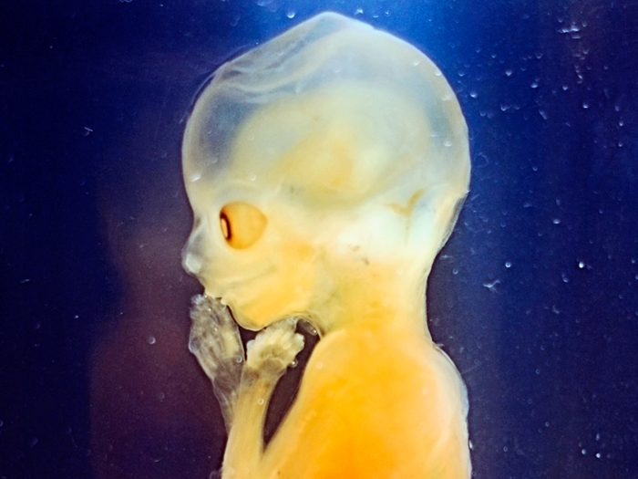 Babies swim in and drink their own pee for about 25 weeks.