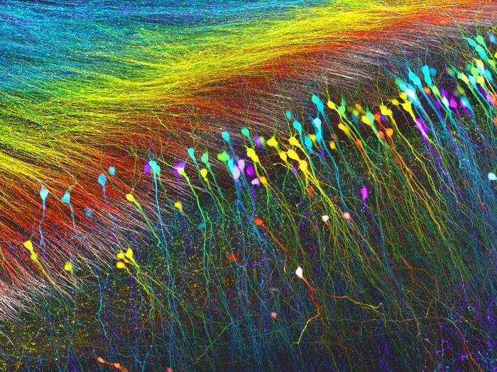 Hippocampal neurons