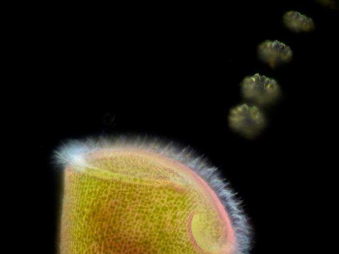 Trumpet animalcule an endosymbionts