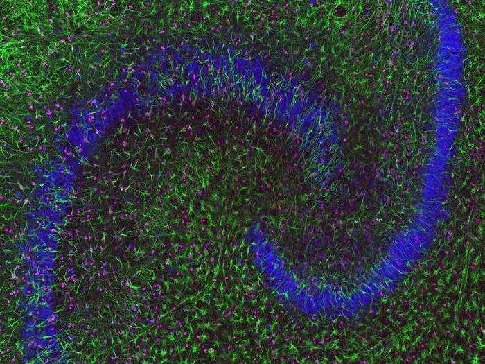 Hippocampal brain slice