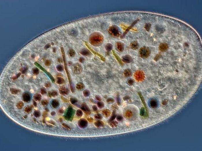 A Frontonia cell showing ingested food, cilia, mouth, and trichocysts