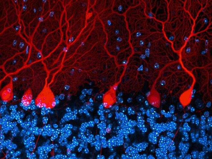 Section of the cerebellum in a brain