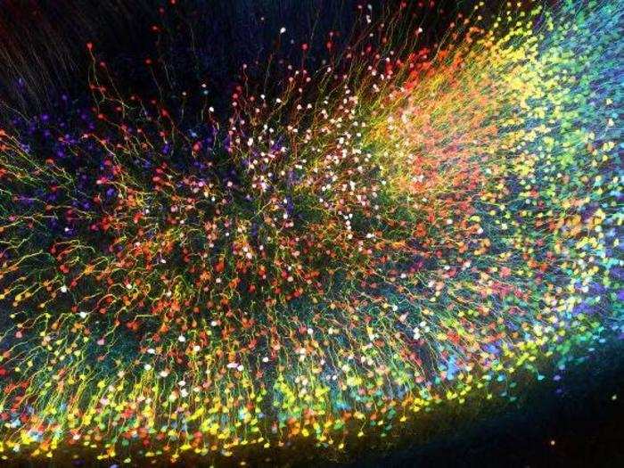 Brain matter of a transgenic mouse in 3D