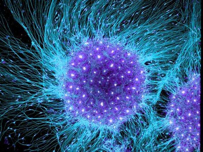 Human brain cells differentiated from embryonic stem cells