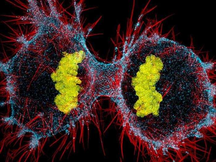 Human HeLa cell undergoing cell division