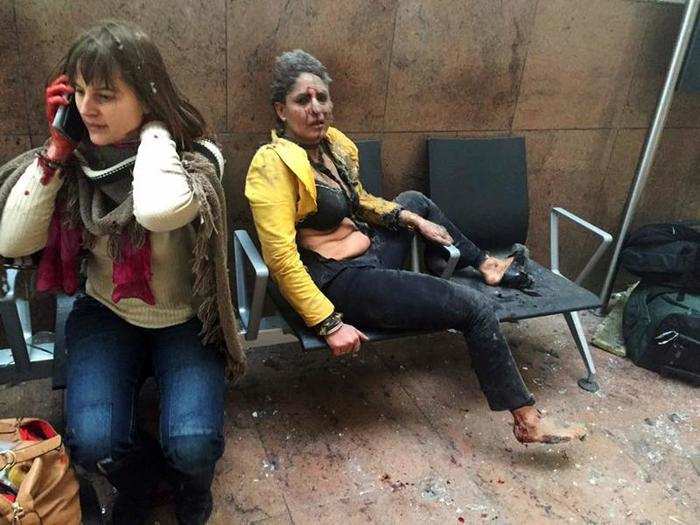 This image of a wounded flight attendant went viral after the Brussels bombing attack in March. Nidhi Chaphekar lay with torn clothes and a bloodied face after 32 civilians were killed in the deadliest terrorist attack in Belgium