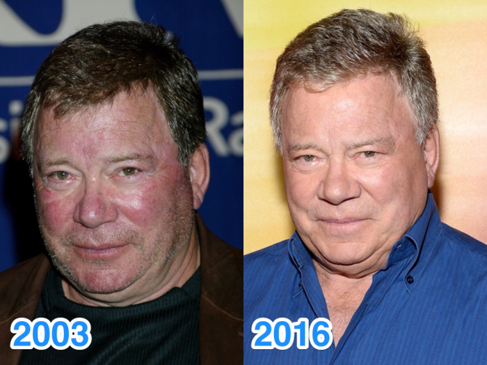 William Shatner almost looks younger now than he did in the early 2000s. He