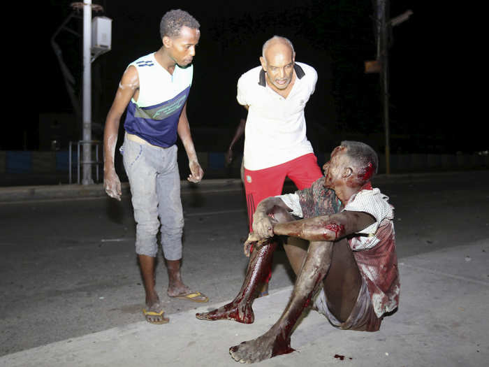 A Somali man injured in a night car bomb attack near a hotel in Hamarweyne district sits along a sidewalk near the scene in Mogadishu, Somalia, on February 26.