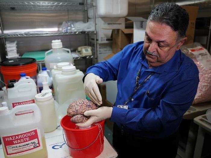 Dr. Haroutunian must handle the brains with care since they are coated in a mixture of formalin, methanol, and formaldehyde.