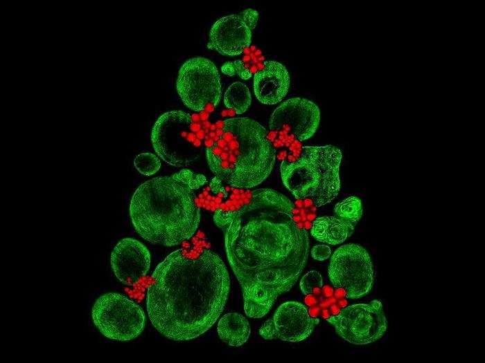 This cartilage-like tissue was composed and colored to look like a Christmas tree.