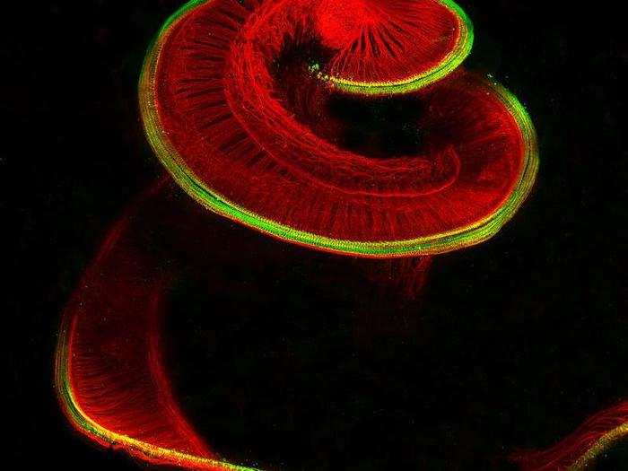 Sensory hair cells (red) and neurons (green) reveal the structure of a rat cochlea (part of the inner ear).