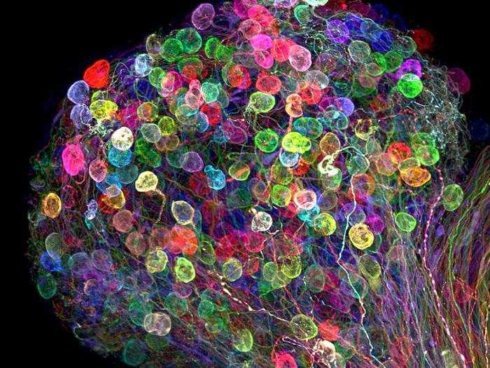 This part of an embryonic chick brain is colored with the "brainbow" genetic technique.