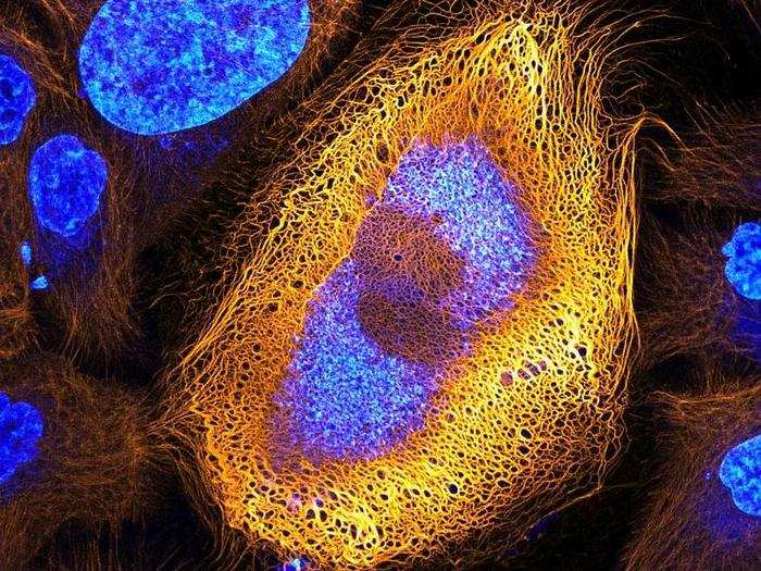 This image won first place. It shows keratin structures in "immortalized" human skin cells, which are increasingly important tools for medical researchers.