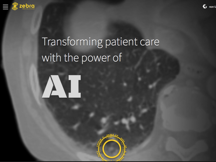 Zebra Medical Vision: AI medical scans in the cloud