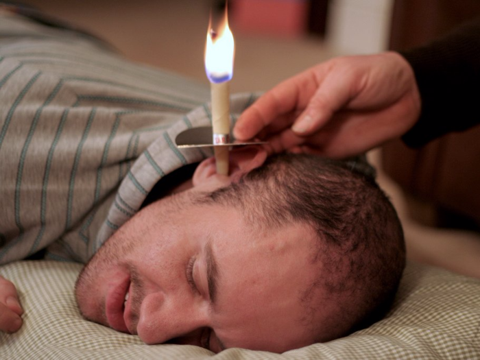 Ear candling