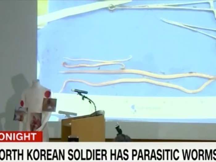 The worms, some of which reached 11 inches long, showed just how poor conditions in North Korea are. The country still uses human excrement to fertilize its crops, which can spread parasites.