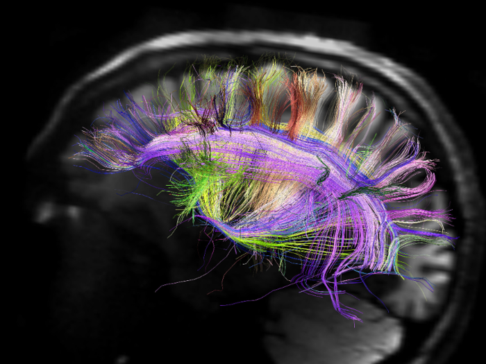 Intermittent fasting may strengthen neural connections and improve memory and mood.