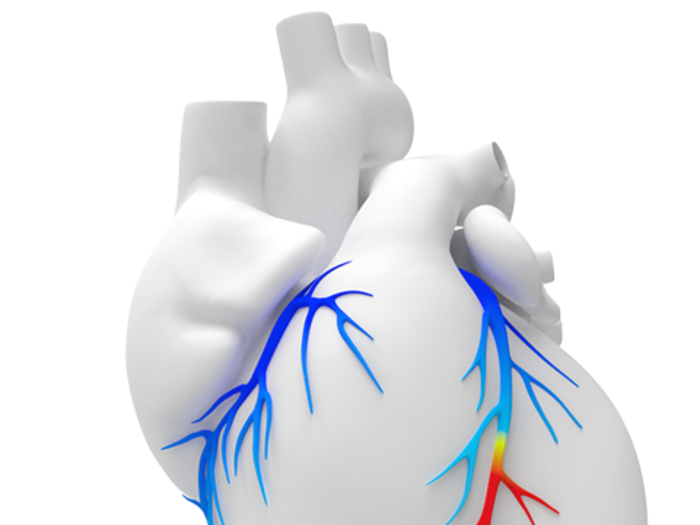 HeartFlow is a competitive medical technology company that has received funding from investors like US Venture Partners and GE Ventures.