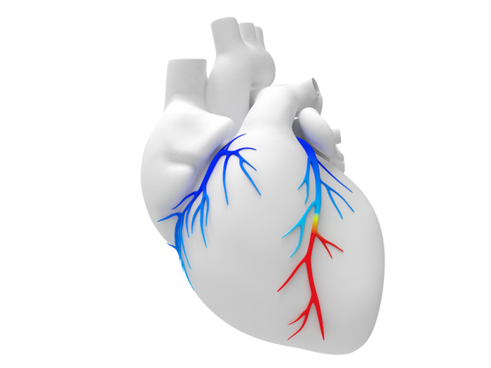 HeartFlow raised $240 million. It provides a non-invasive at-home cardiac test for patients.