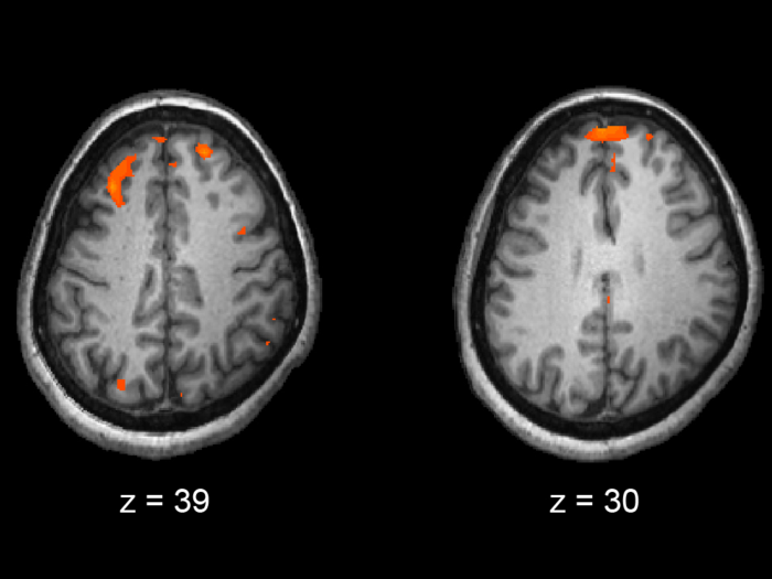 Could a drug actually help treat trauma and other psychological disorders by rewiring the mind? Research into psychedelics seeks to answer that question (to some degree).