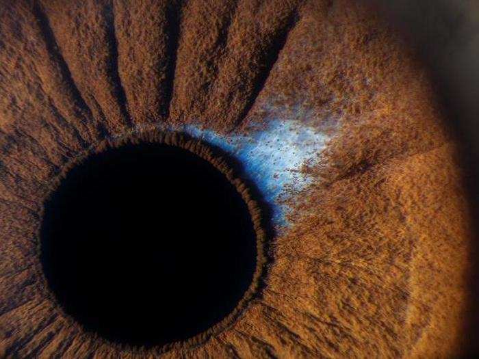 The iris of a human eye, with a "freckle" shown in blue.