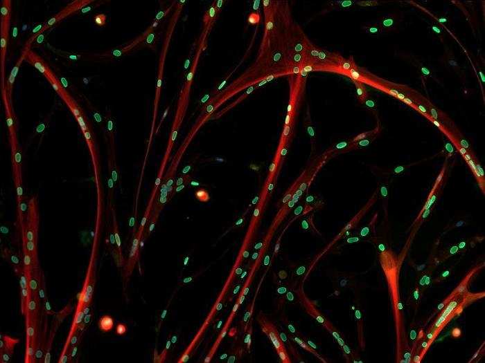 Skeletal muscle cells.