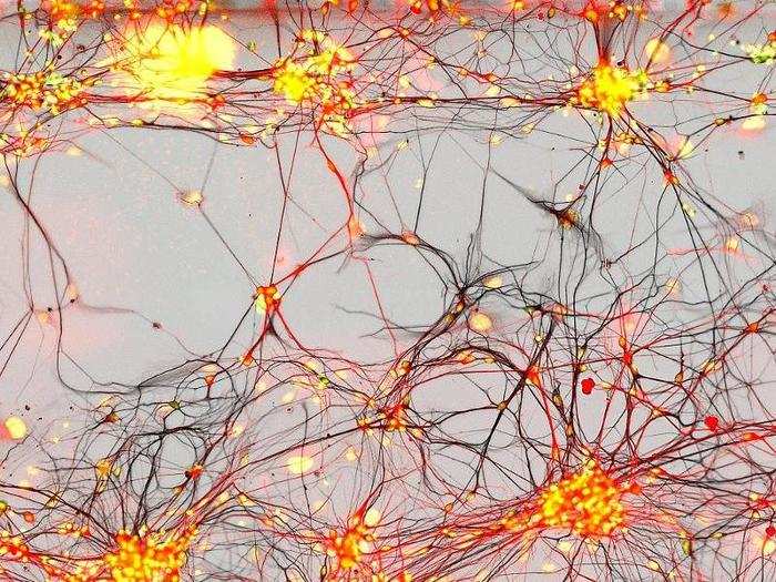 Human neurons from Parkinson patients.